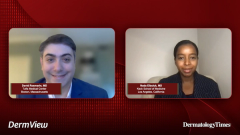 EP. 1 Overview of Vitiligo