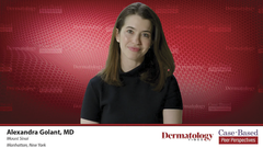 EP. 8 Management of Atopic Dermatitis With Hand and Foot Involvement