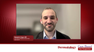 Case 1: Assessing Psychosocial Burden and Realistic Goals in a Patient with Alopecia Areata