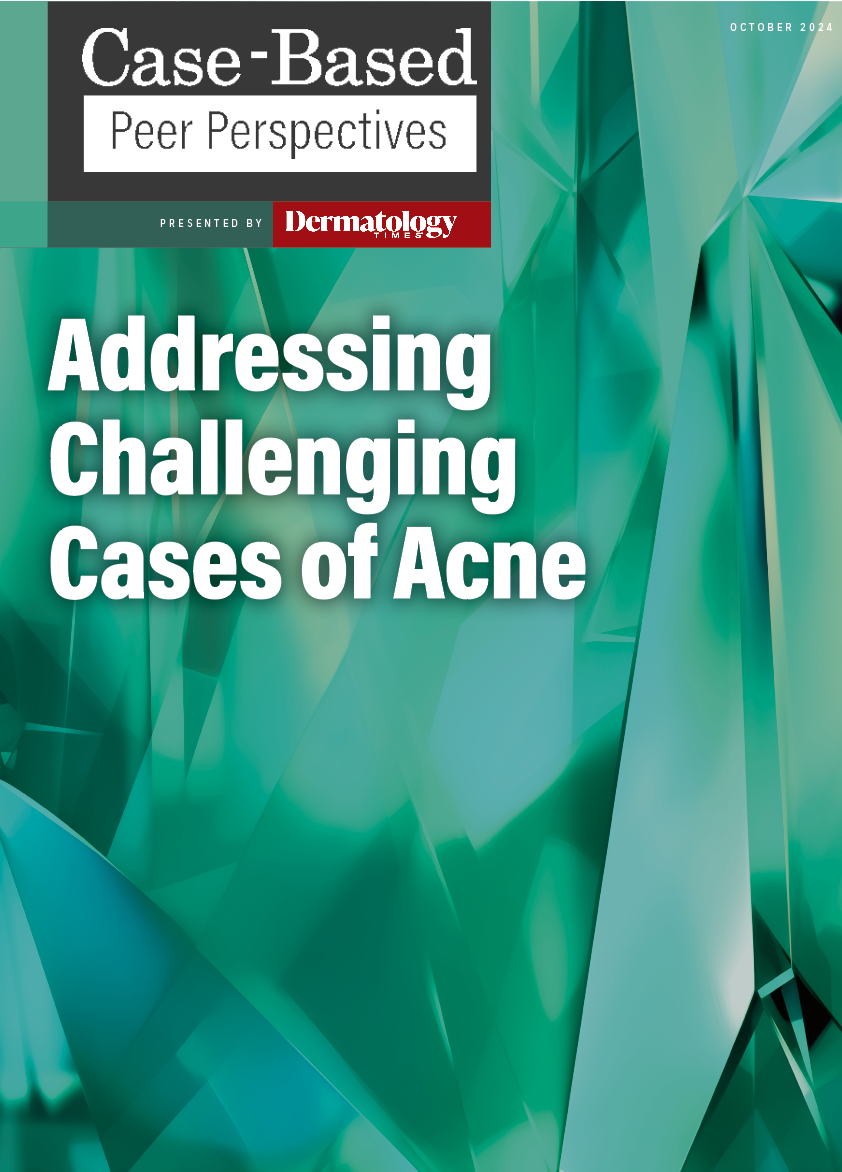 Addressing Challenging Cases of Acne: Part 2