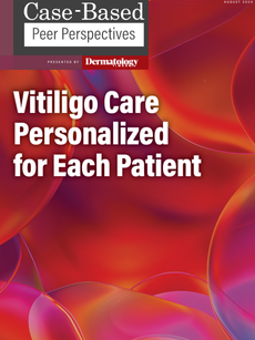 Dermatology Times, Vitiligo Care Personalized for Each Patient, August 2024 (Vol. 45. Supp. 05)