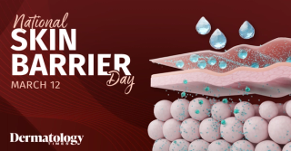 National Skin Barrier Day 2026: Practical Patient Counseling Tips from Skin of Color Experts