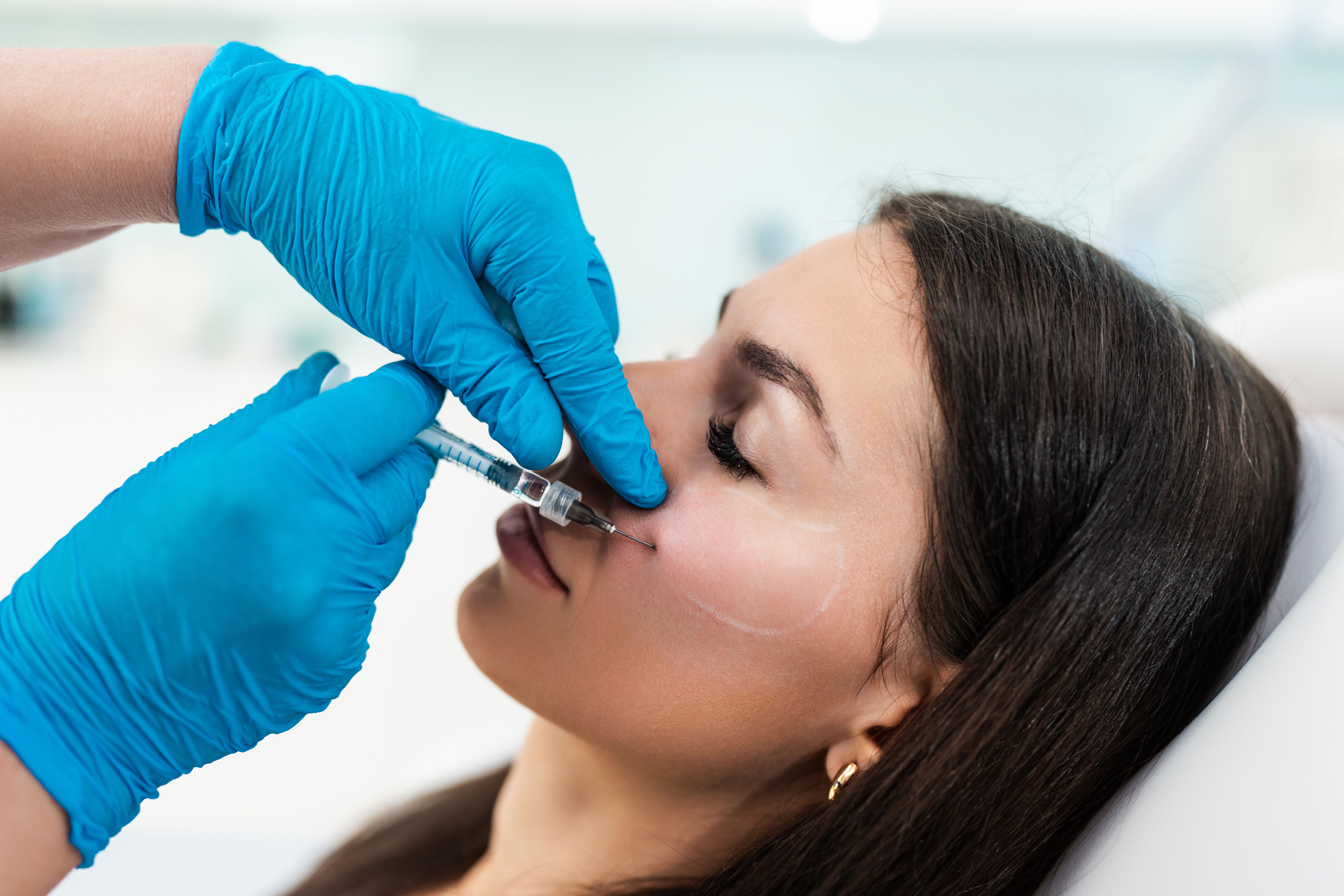 ART Filler Fine Lines Injections Provide Safe and Long-Term Aesthetic ...