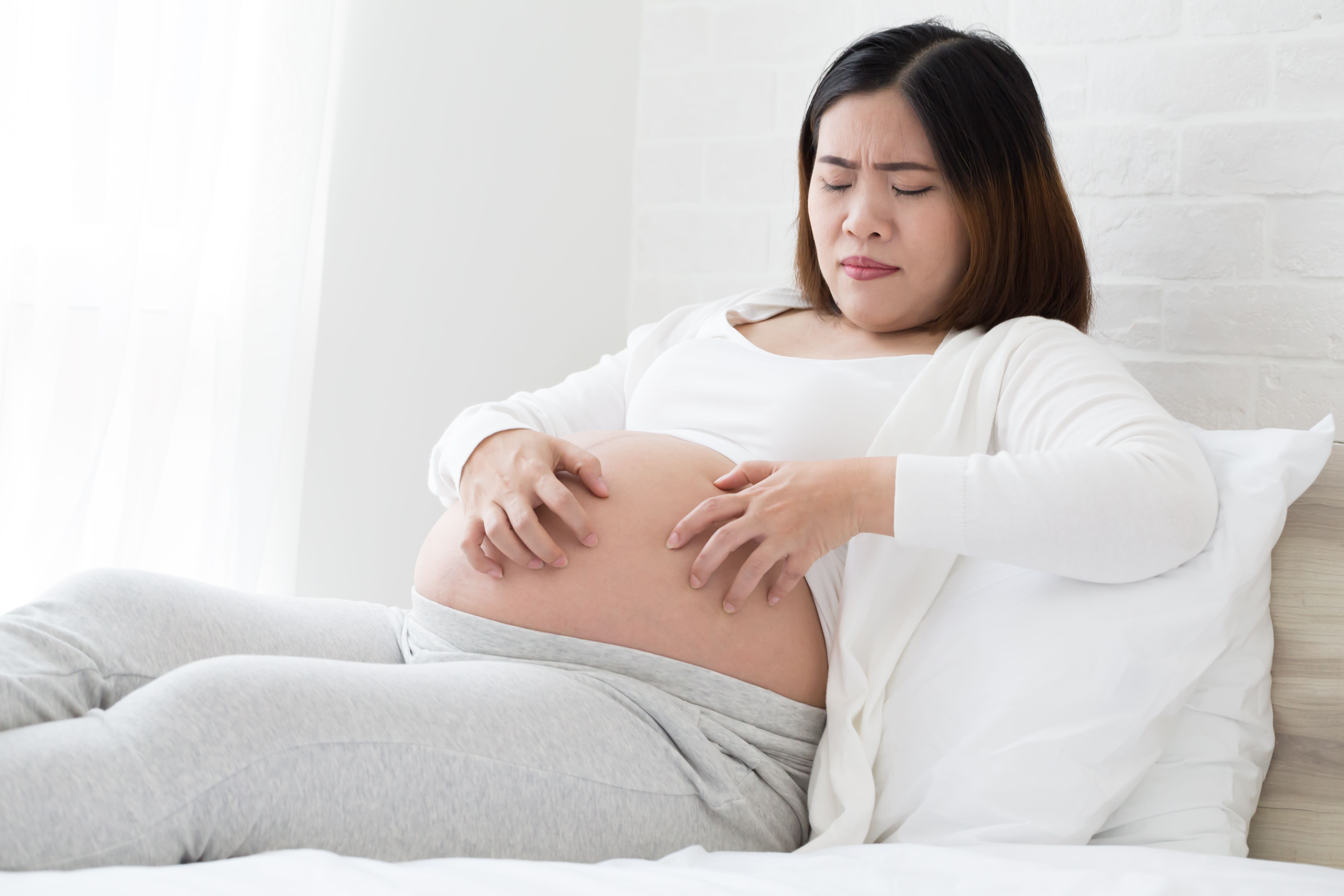Researchers Investigate Psoriasis and Adverse Pregnancy Outcomes