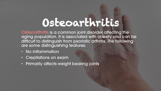 Osteoarthritis psoriatic arthritis differential diagnosis