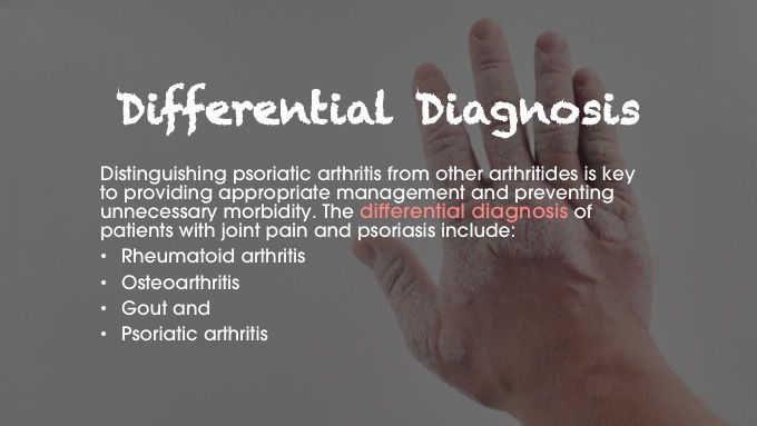 psoriatic arthritis differential diagnosis