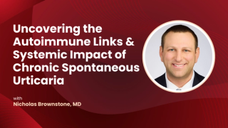 Uncovering the Autoimmune Links & Systemic Impact of Chronic Spontaneous Urticaria