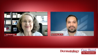 Differential Diagnosis of GPP