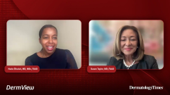 EP. 1 Understanding Vitiligo: From Cosmetic Misconception to Autoimmune Reality