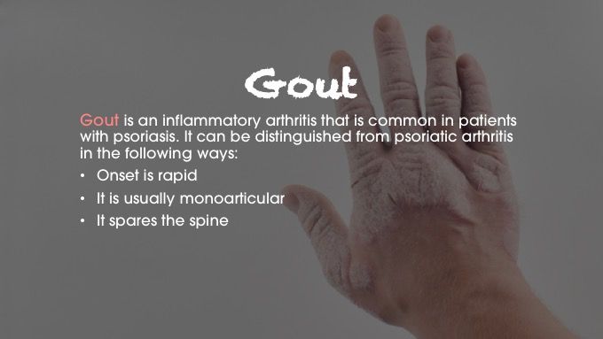 gout psoriatic arthritis differential diagnosis