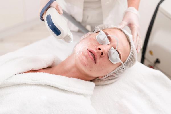 Multimodal PRP, Laser, and LED Protocol Explored for Acne Sequelae