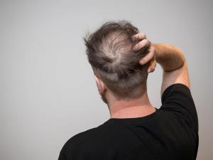 Nutrafol Expands Portfolio with First and Only Hair Loss Supplement for Male Patients 50 and Older