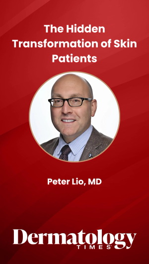 The Hidden Transformation of Skin Patients