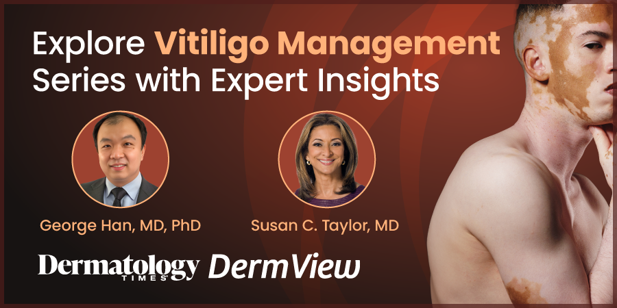 Explore Vitiligo Management 