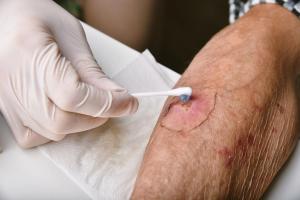 Wound Care Belongs at the Heart of Dermatology