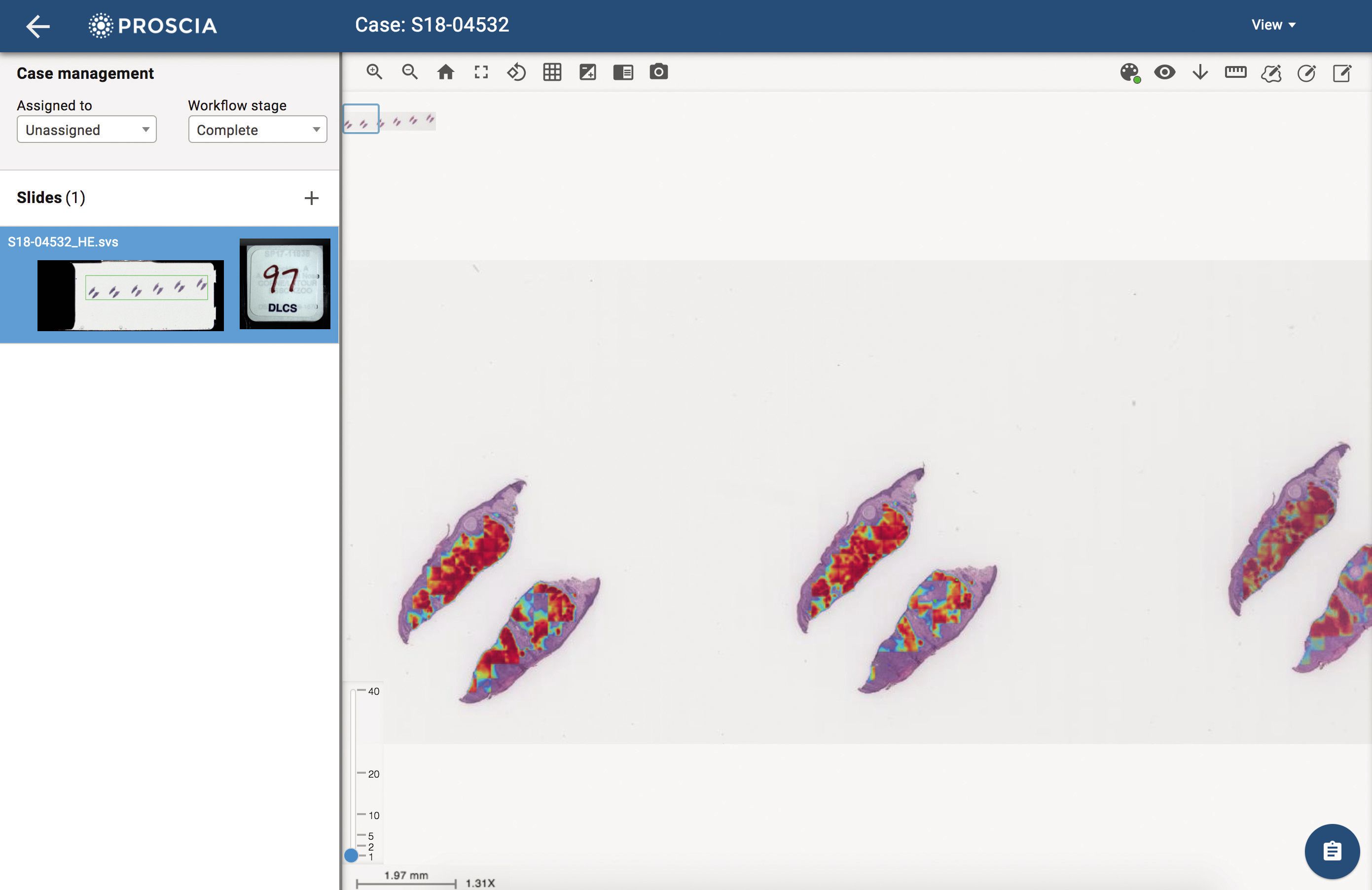 artificial intelligence software dermatology