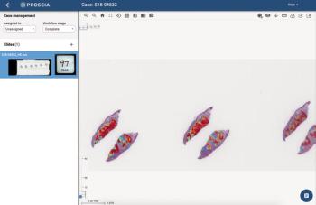 artificial intelligence software dermatology