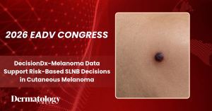 EADV 2026: DecisionDx-Melanoma Data Support Risk-Based SLNB Decisions in Cutaneous Melanoma
