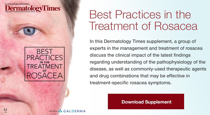 Best Practices In The Treatment Of Rosacea Dermatology Times And Multimedia Medical Llc 