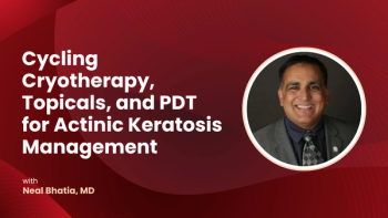 Cycling Cryotherapy, Topicals, and PDT for Actinic Keratosis Management