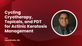 Cycling Cryotherapy, Topicals, and PDT for Actinic Keratosis Management