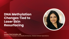 DNA Methylation Changes Tied to Laser Skin Resurfacing