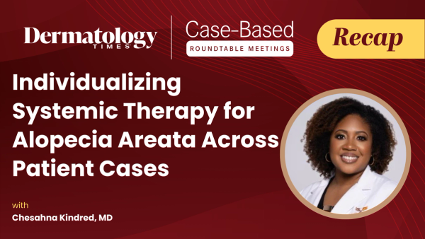 Individualizing Systemic Therapy for Alopecia Areata Across Patient Cases