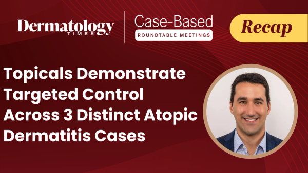 Topicals Demonstrate Targeted Control Across 3 Distinct Atopic Dermatitis Cases