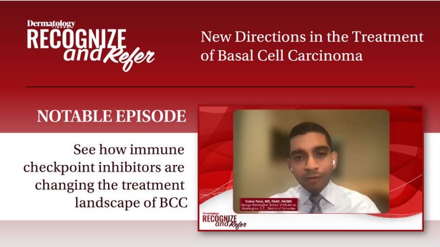 Recognize and Refer New Directions in the Treatment of Basal Cell Carcinoma