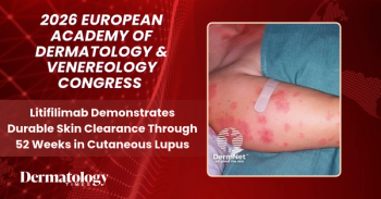 Litifilimab Demonstrates Durable Skin Clearance Through 52 Weeks in Cutaneous Lupus