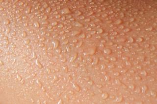 Hyperhidrosis and Emerging Treatments