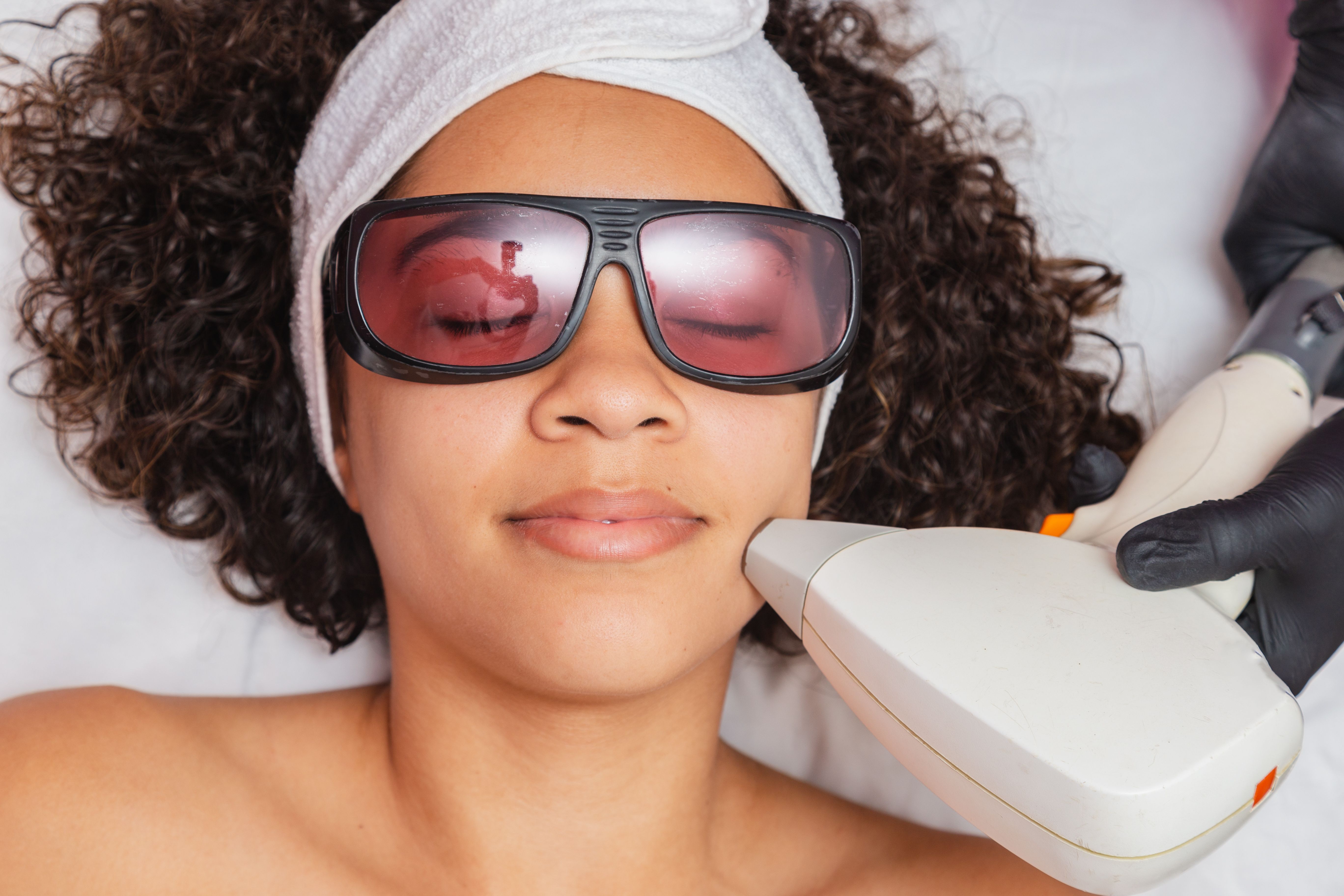 Dual-Wavelength Low Power Lasers Increase Photosensitivity Risk in Skin of Color
