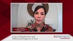 EP. 5 Clinical Manifestation and Differential Diagnosis of Acne