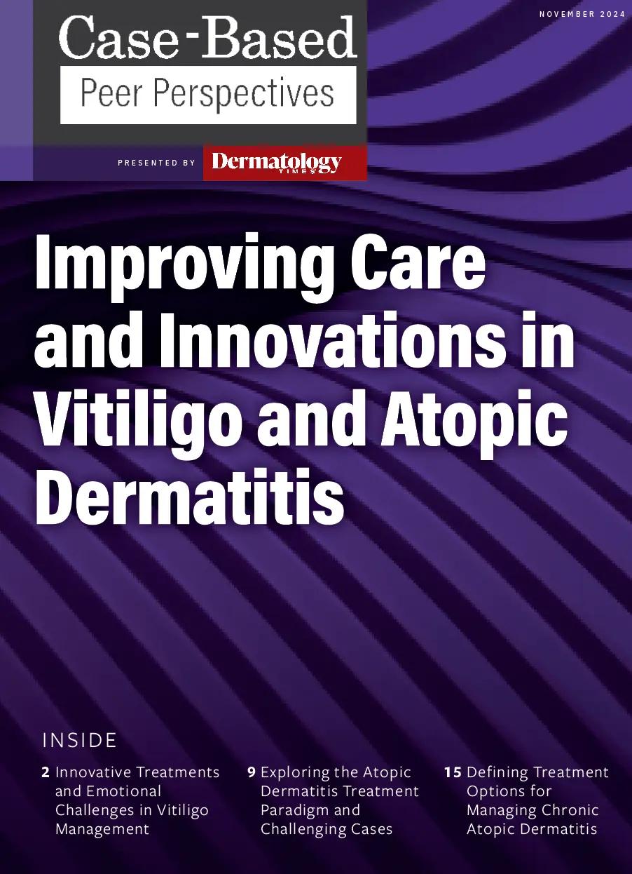 Exploring the Atopic Dermatitis Treatment Paradigm and Challenging Cases: Part 2