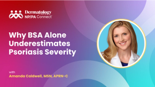 Why BSA Alone Underestimates Psoriasis Severity