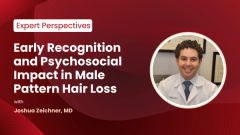 EP. 1 Early Recognition and Psychosocial Impact in Male Pattern Hair Loss