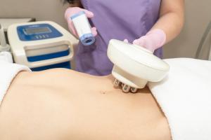Treating Postpartum Abdominal Skin Laxity with Bipolar Microneedle Radiofrequency