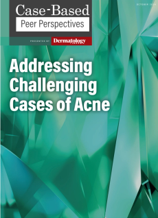 Dermatology Times, Addressing Challenging Cases of Acne, October 2024 (Vol. 45. Supp. 06)
