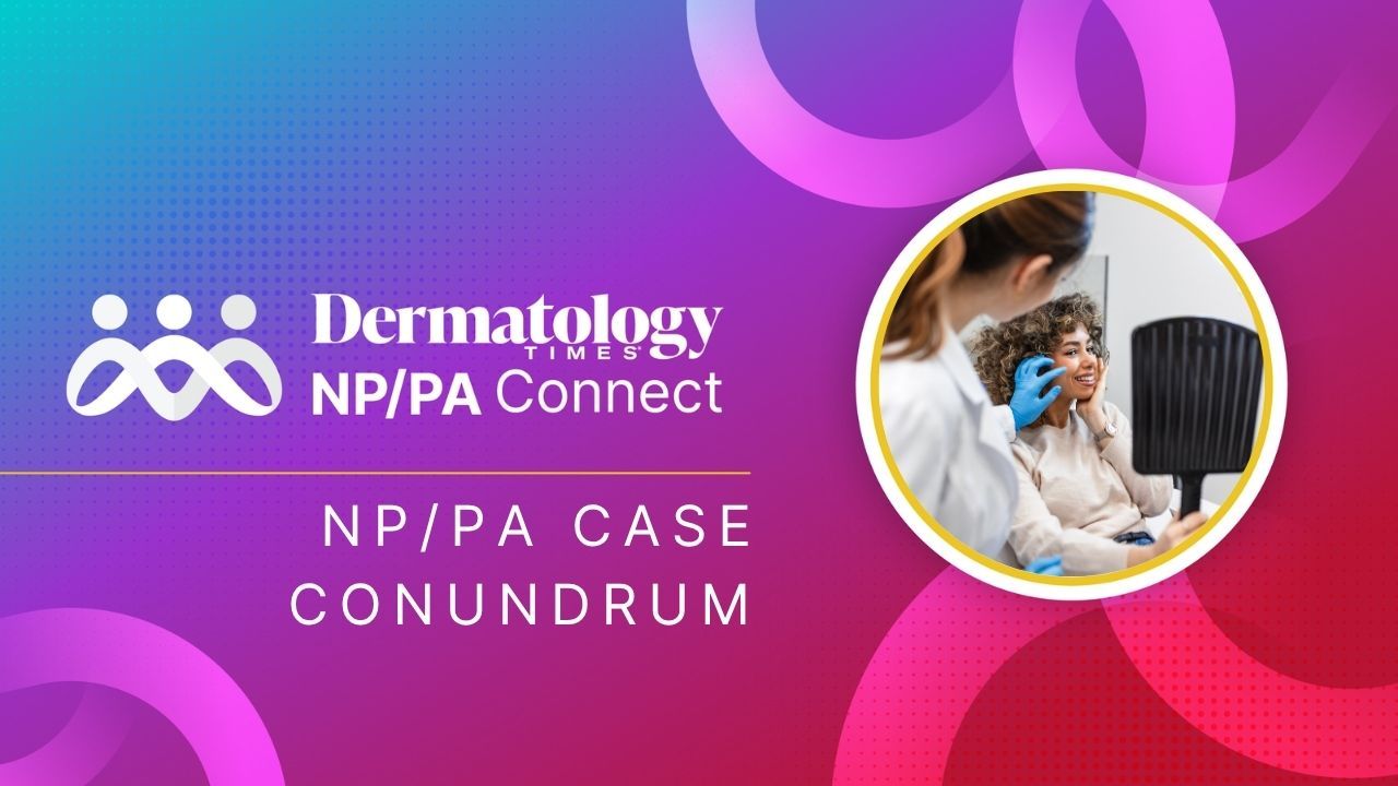 In the Chair: Psoriasis–Atopic Dermatitis Overlap