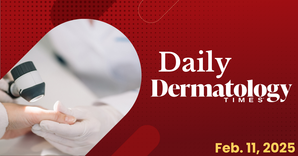 Daily Derm Times: February 11, 2025