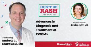 Don't Be Rash: Advances in Diagnosis and Treatment of Port Wine Capillary Malformations
