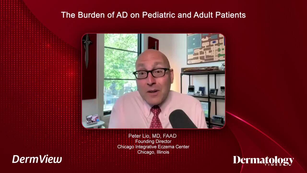 Experts on atopic dermatitis.