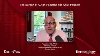 Experts on atopic dermatitis. 