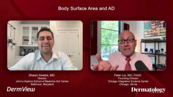 Experts discuss atopic dermatitis. 