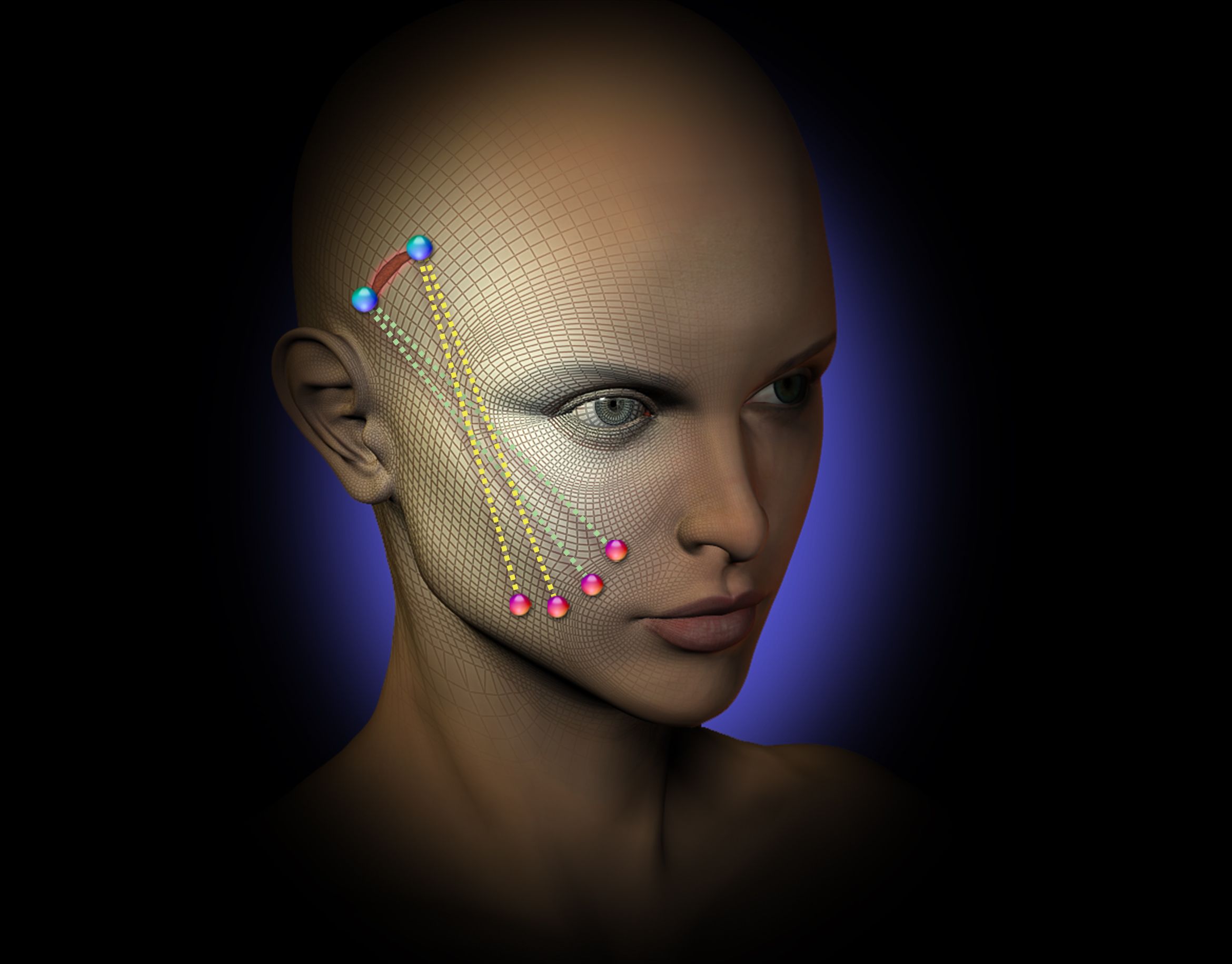Under suspension: Suture lift technique permits retention of facial tissue