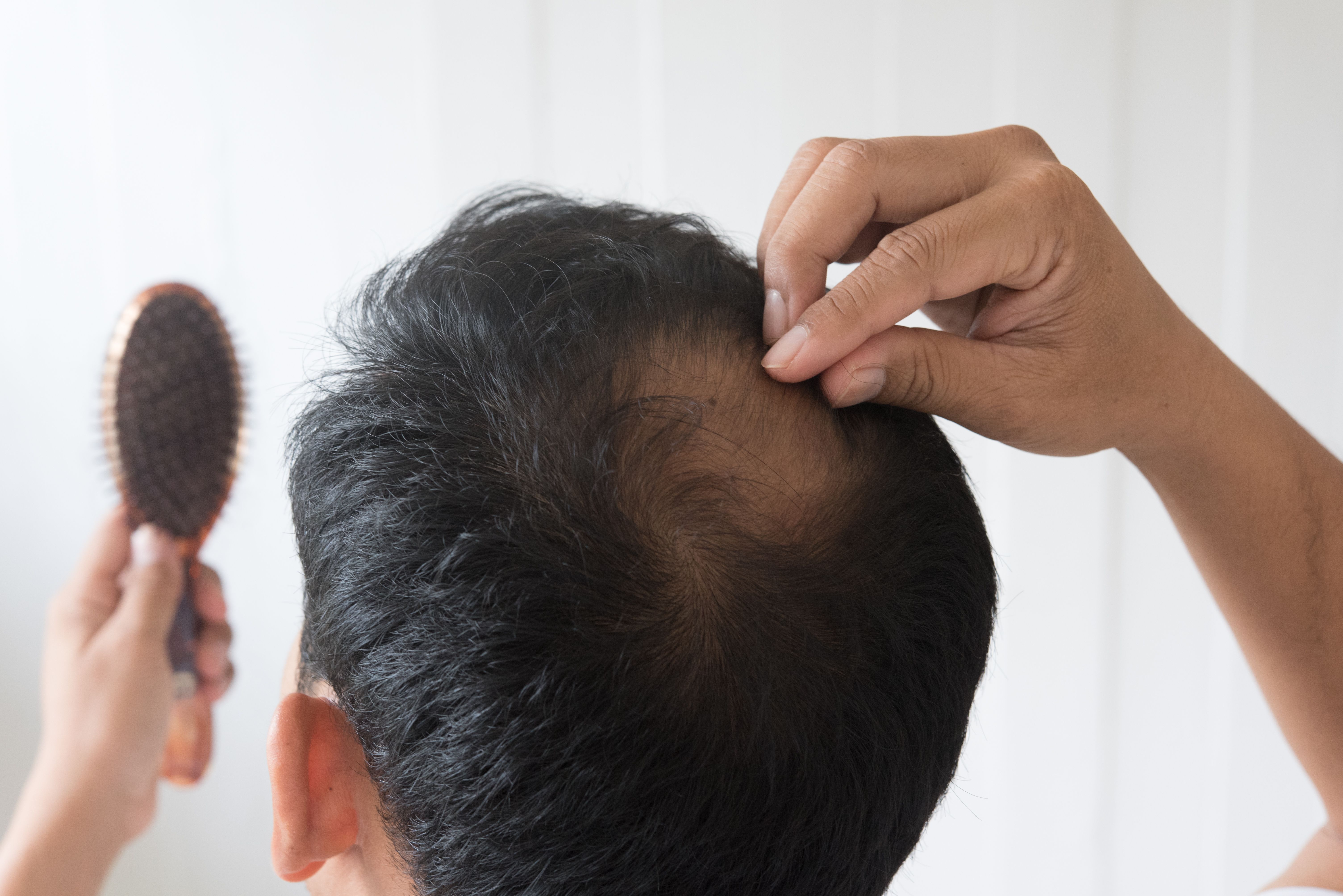Mallia Aesthetics Completes Regulatory Milestones for Novel sCD83-Based Hair Growth Technology