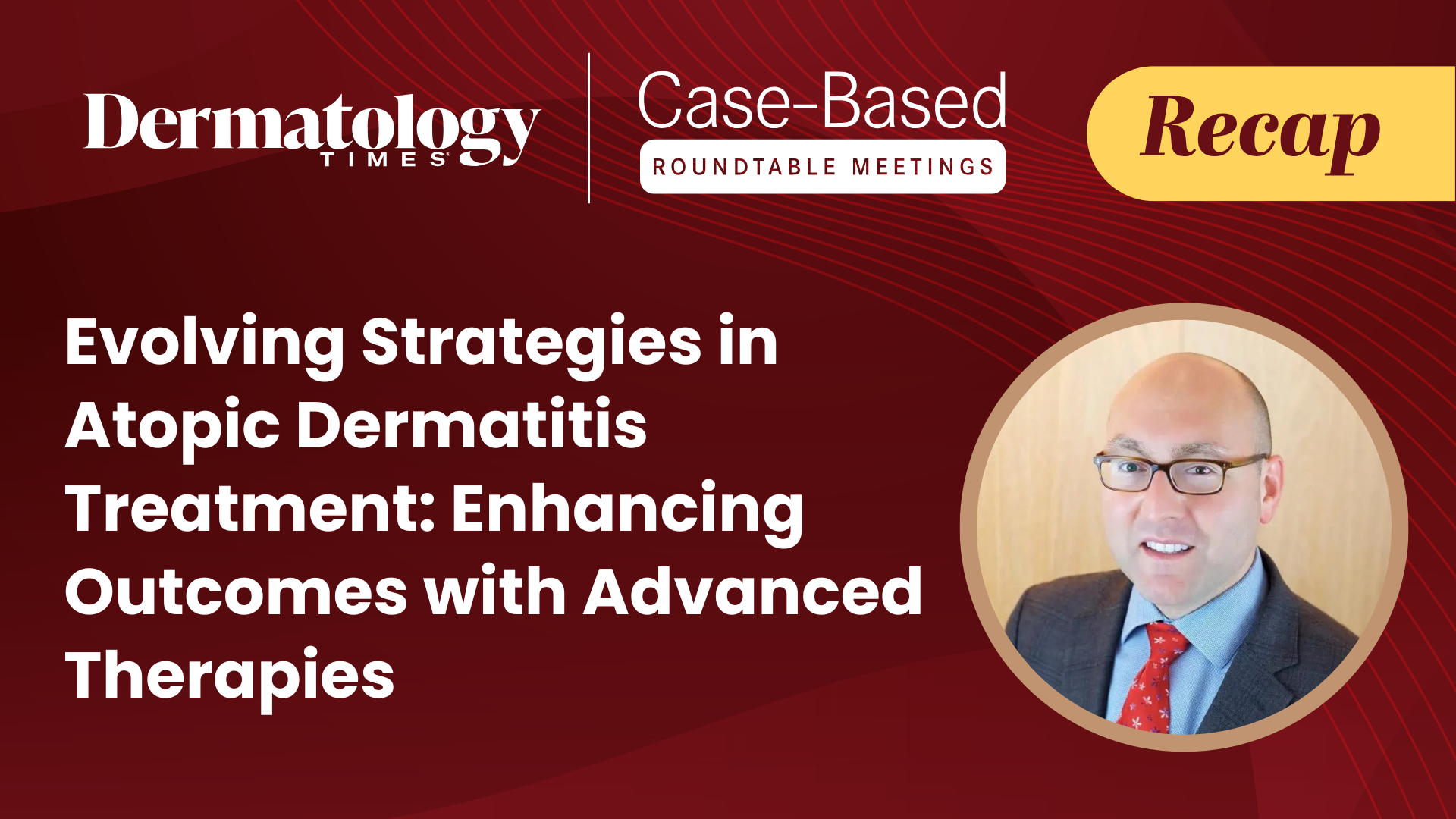 Expert Insights on Personalizing Atopic Dermatitis Treatment