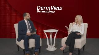 Experts discuss plaque psoriasis.