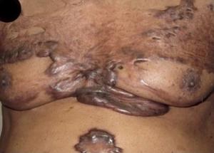 Image IQ: When is a biopsy required?