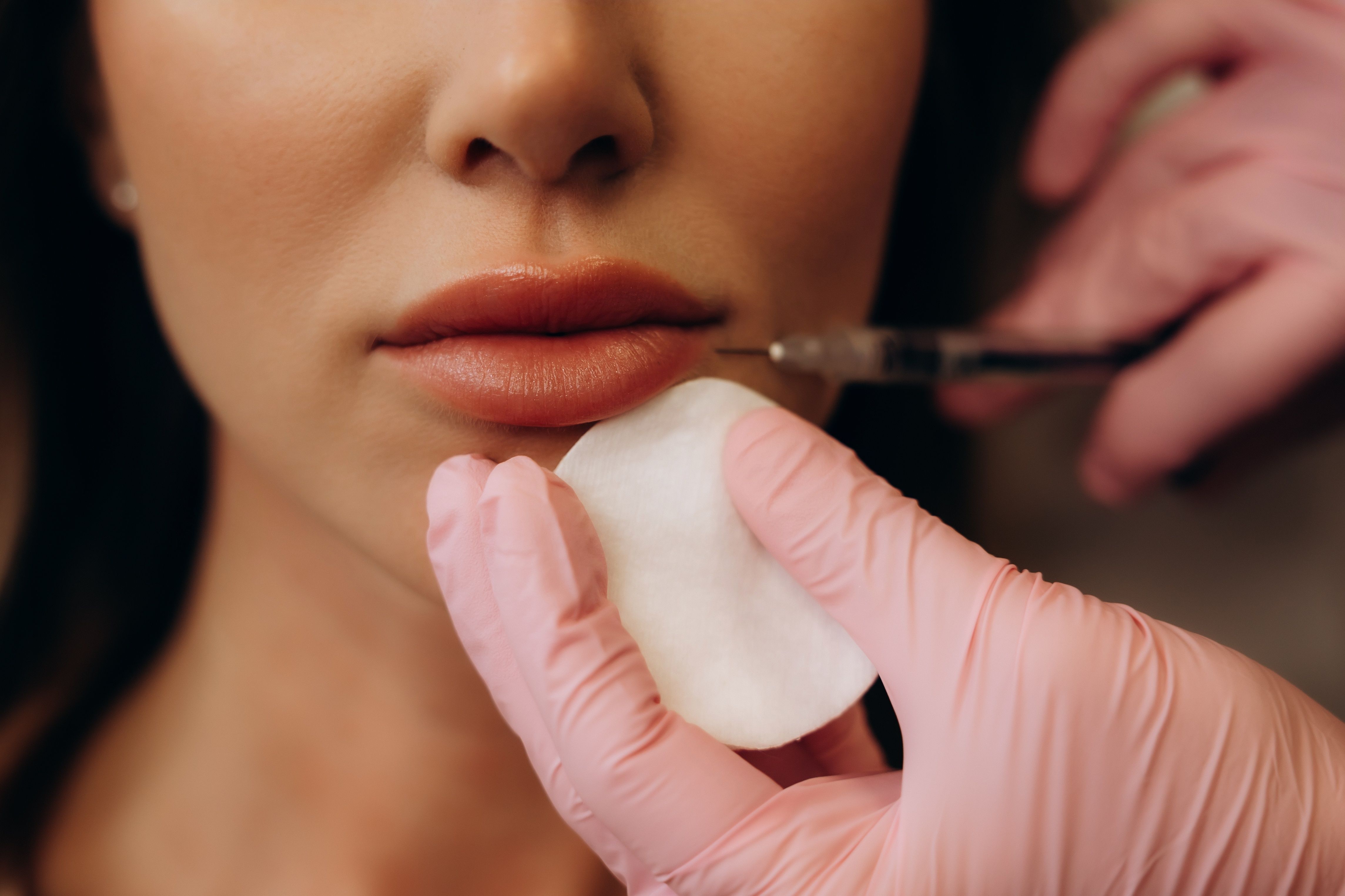 Merz Expands BELOTERO Portfolio With Two New FDA-Approved Hyaluronic Acid Fillers